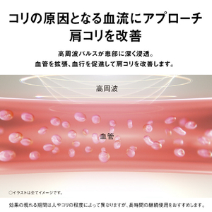 パナソニック 高周波治療器 コリコランループ グレージュ EW-RA520-H-イメージ5